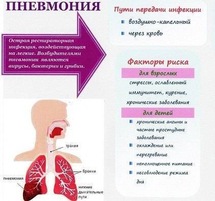 Воспаление легких (пневмония)