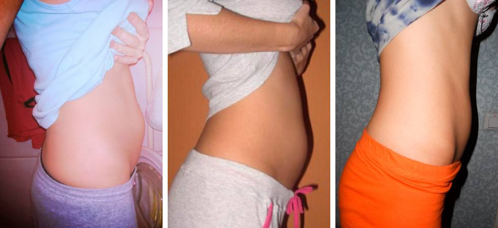 Развитие ребенка на 9 месяце беременности — медицинский женский центр в москве