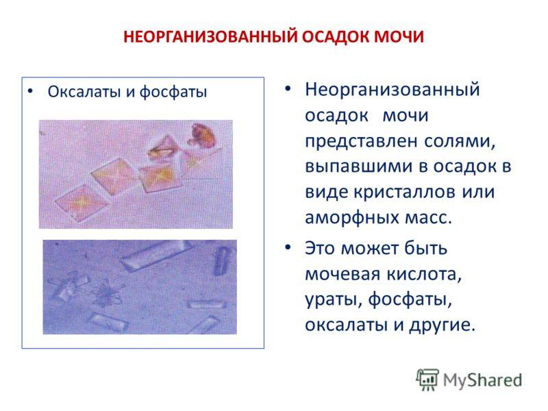 Соли в моче какие. Оксалаты кальция в осадке мочи. Соли оксалаты в моче. Оксалаты и фосфаты в моче. Соли Ураты и оксалаты в моче.