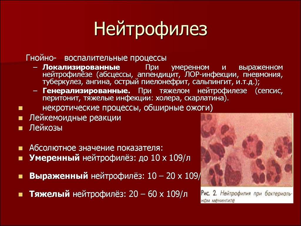 Болезнь крона: что это такое? симптомы, причины и лечение болезни крона у взрослых