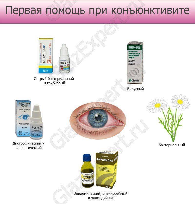 Как правильно обрабатывать глаза при конъюнктивите? - энциклопедия ochkov.net