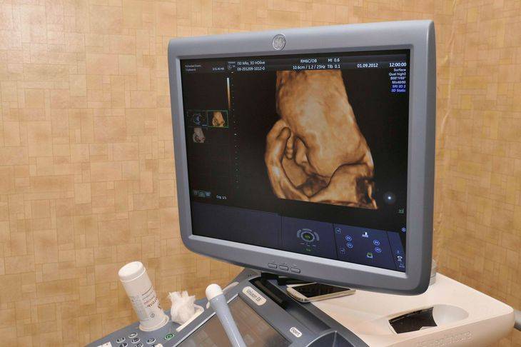 Узи на 8 неделе беременности: как делают, что покажет ультразвук, нормы и расшифровка