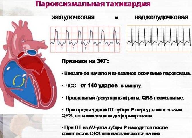 Врожденные пороки сердца у детей - причины заболевания и первые симптомы, профилактика и лечение болезни