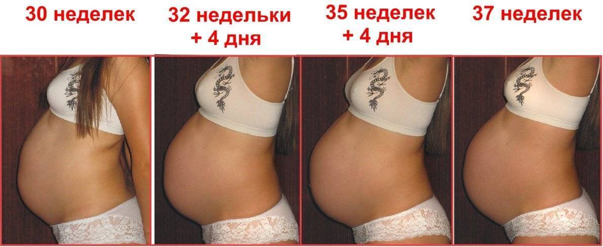 39 неделя беременности вторая беременность роды. Опущение живота передбродами. Опущение живота перед родами. Упощеннвй живот.