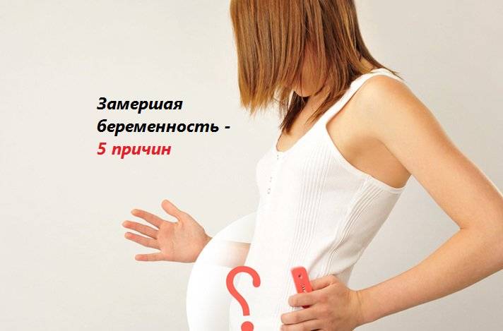 Осложнения беременности: все о возможных генетических рисках | «юнона»