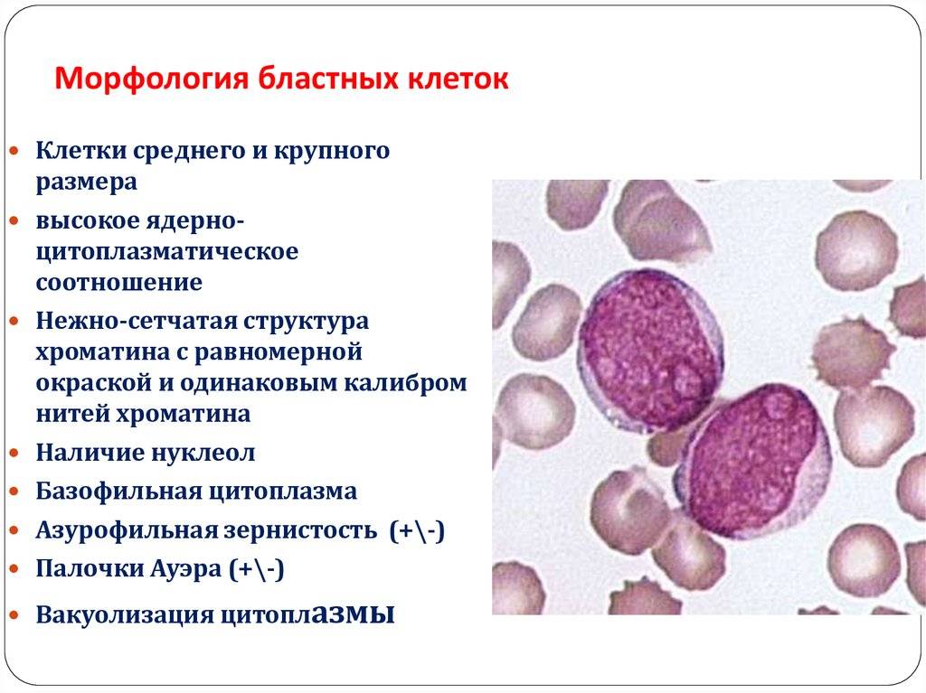 Ревматологическое обследование. анализ крови на уровень мочевой кислоты, ревматоидный фактор и пр.