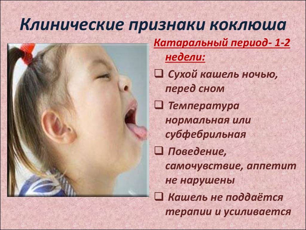 Сильный сухой лающий кашель у ребенка без температуры