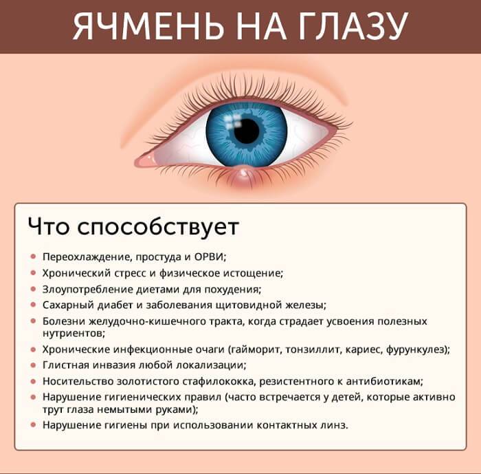Доктор Комаровский о том, как лечить ячмень на глазу у ребенка