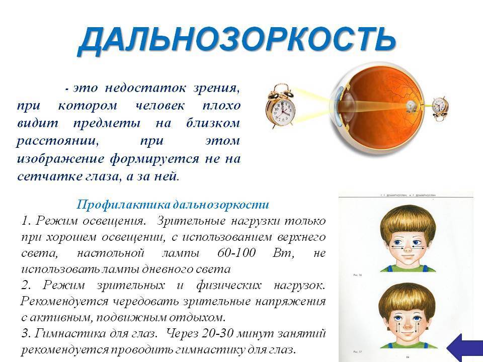 Как лечить близорукость у детей - энциклопедия ochkov.net