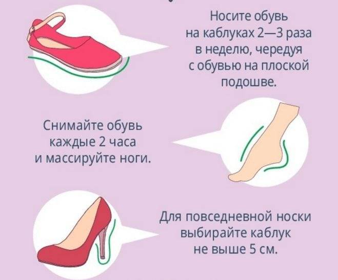 Какую обувь можно носить беременным?