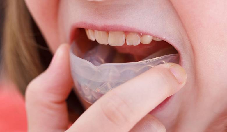 Бруксизм: ребенок скрипит зубами