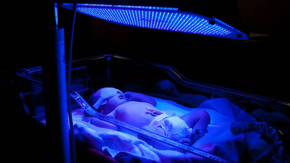 Фототерапия для новорожденных при желтухе сколько длится