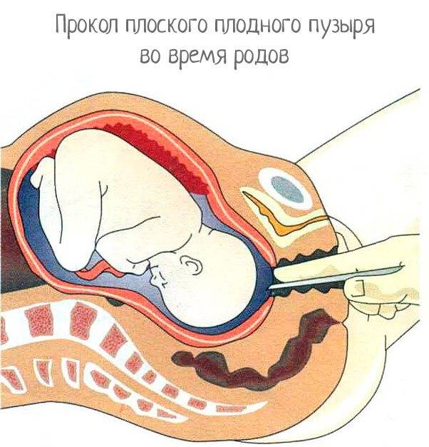 Кольпоскопия шейки матки: что это? рекомендации гинеколога