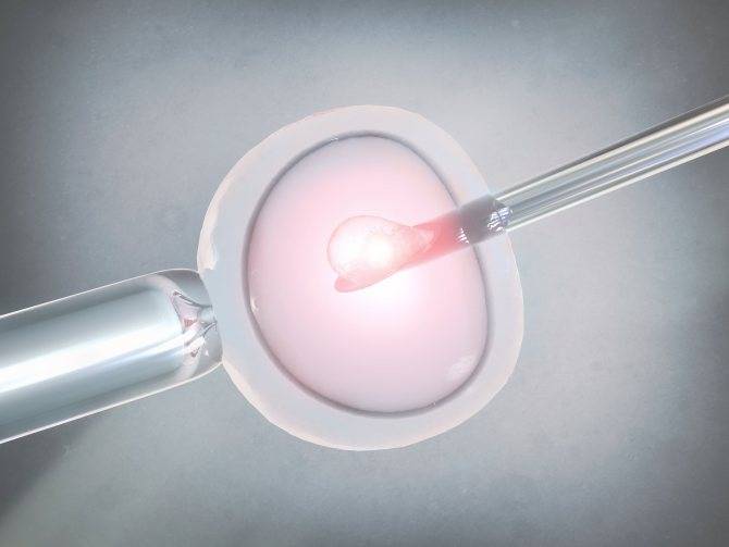 Подсадка (перенос) эмбрионов при эко