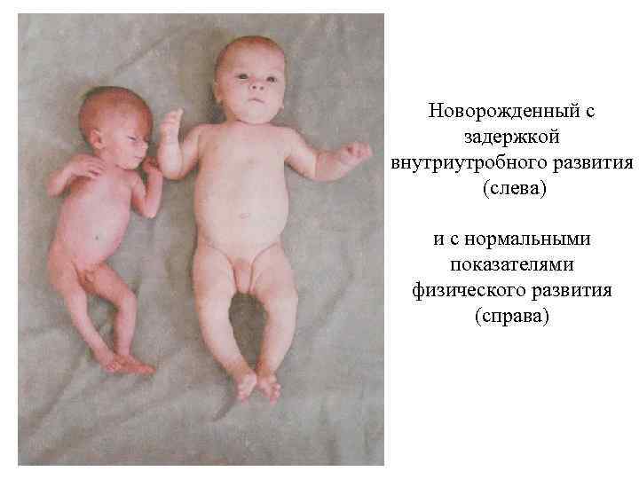 Роды при сахарном диабете - цена контракта на ведение беременности и родов с патологией в клинике «мать и дитя» в москве