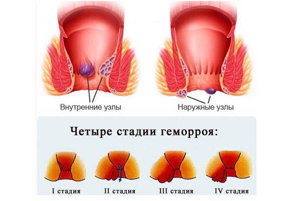 Дизартрия у детей: что делать?