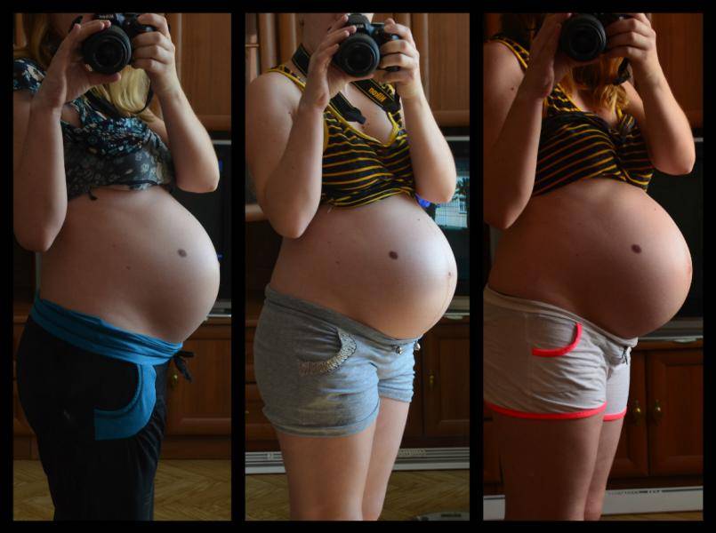Опущение живота при беременности у первородящих фото