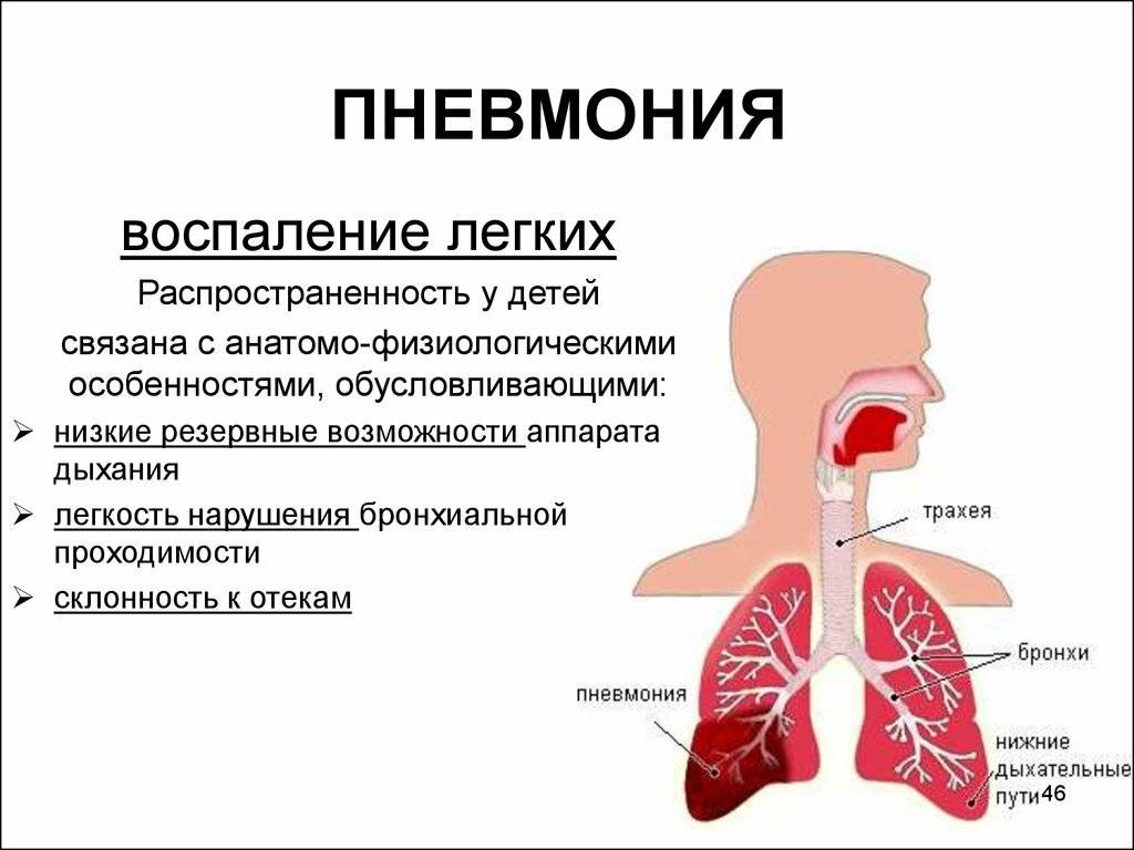 Презентация заболевания дыхательных путей