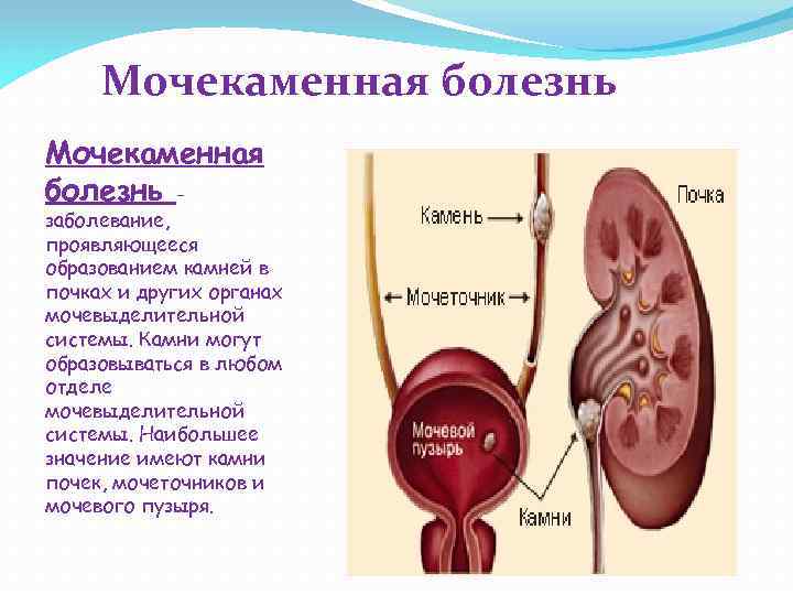 Презентация по теме заболевания мочевыделительной системы