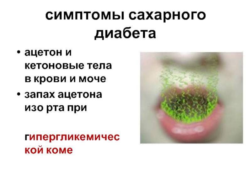 Ацетон у ребенка