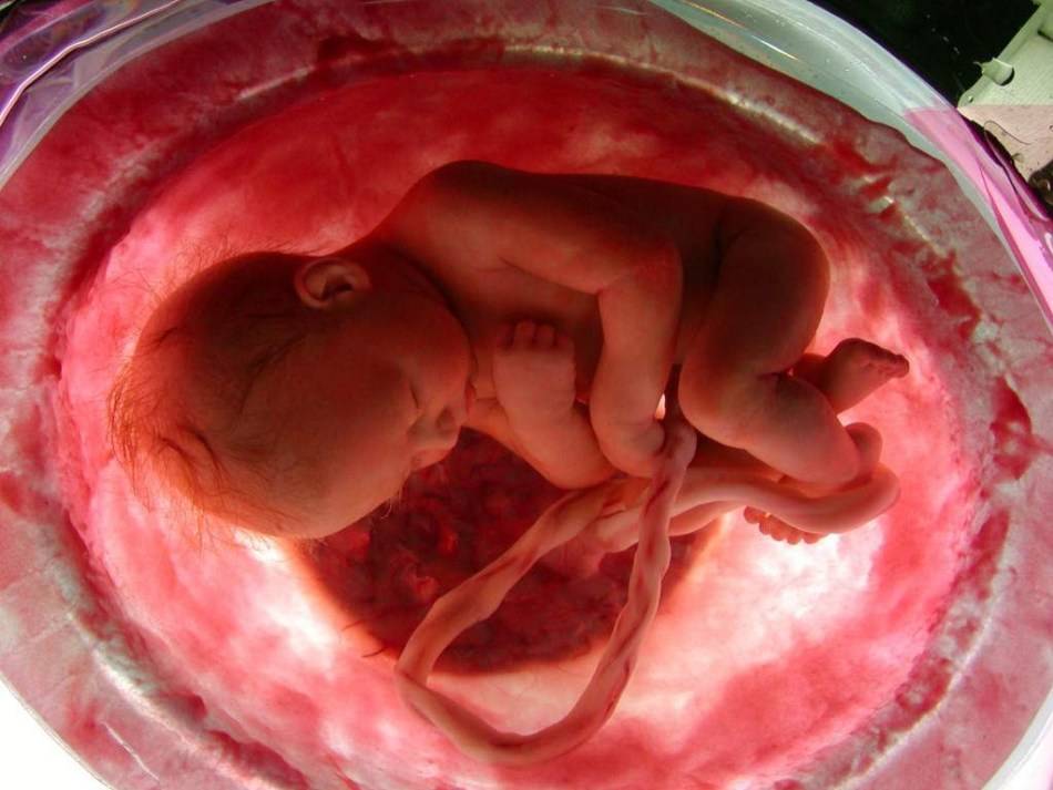 Преимплантационный генетический анализ эмбрионов