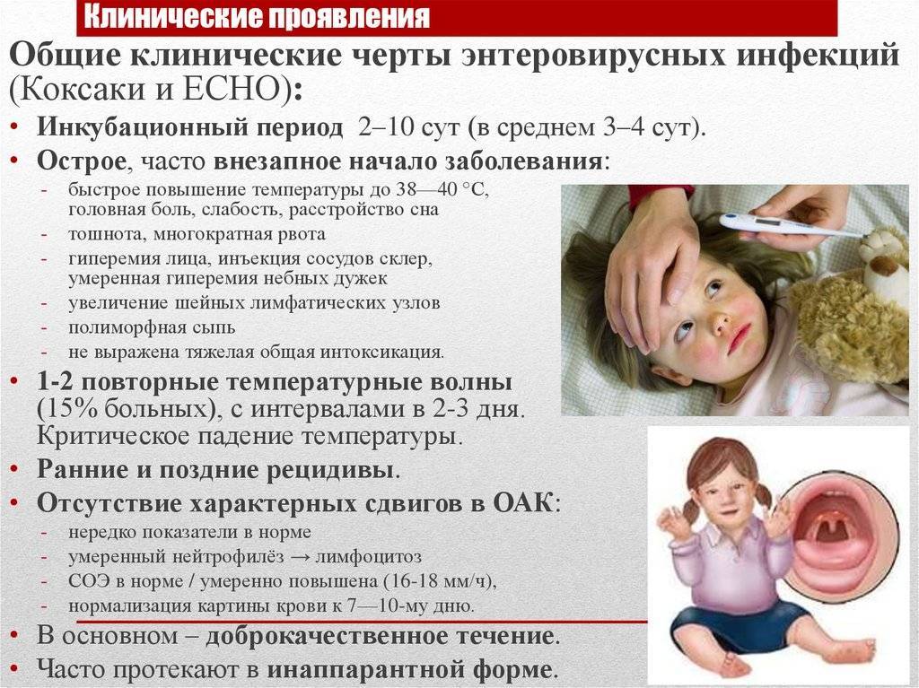 Доктор Комаровский о симптомах и лечении мононуклеоза у детей