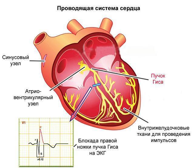 Нарушения проводимости сердца