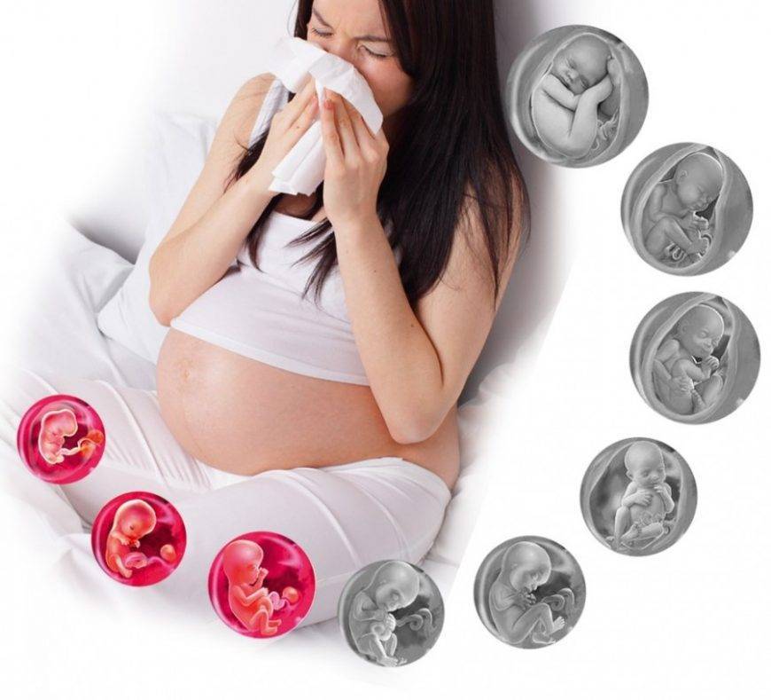 Боли в горле при беременности