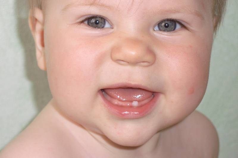 Кашель при прорезывании зубов у ребенка