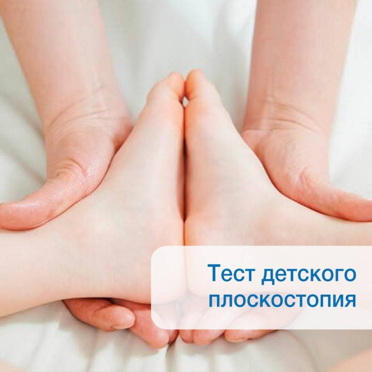 Плоскостопие у детей врач