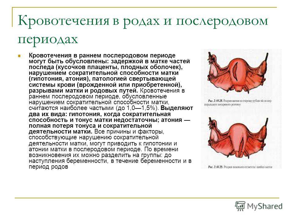 Кровотечение после родов сколько