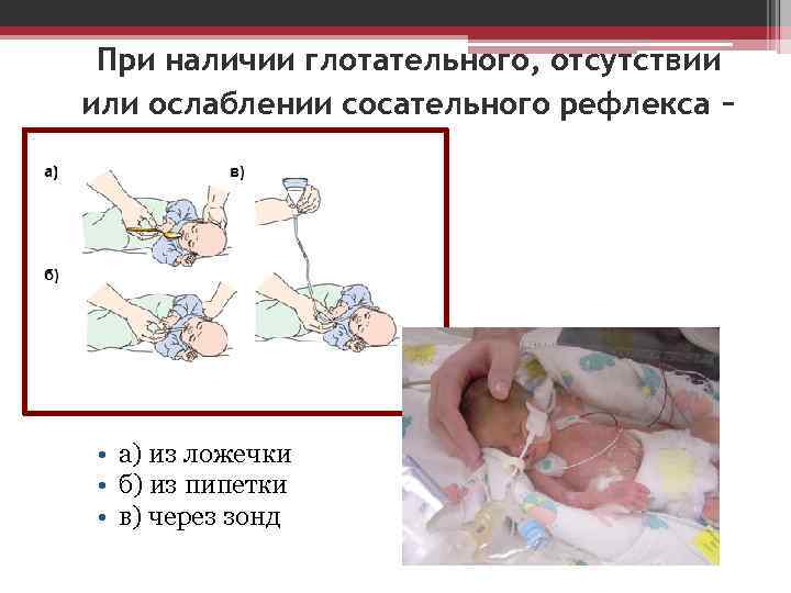 Развитие ребенка с синдромом дауна: от 0 до 19 месяцев