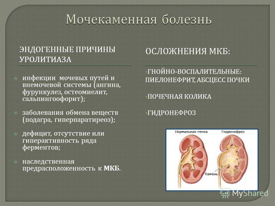 Камни в почках и мочевом пузыре, симптомы и лечение камней в почках (мочекаменная болезнь)