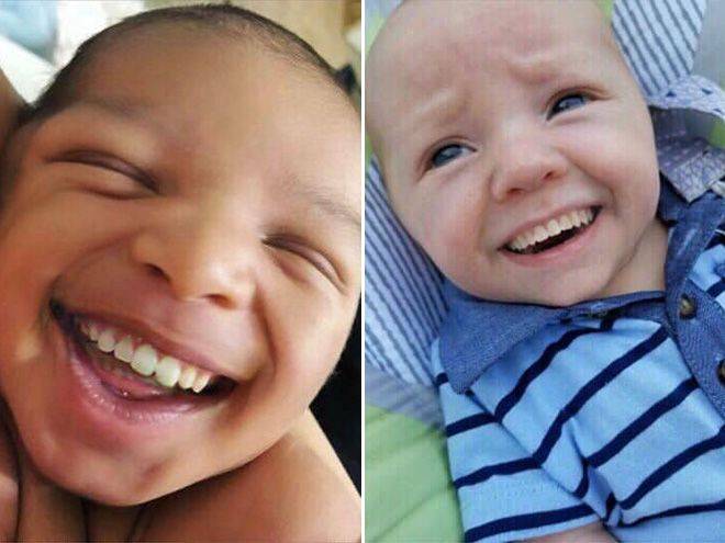 Ребенок родился с зубами — фото, причины, приметы