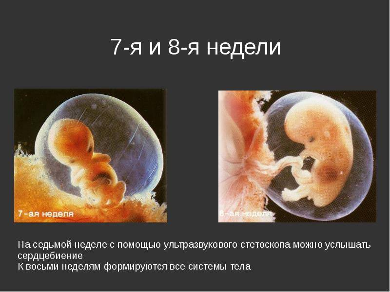 7 неделя беременности – что происходит, узи и развитие плода, вес ребенка и живот на седьмой неделе беременности – agulife.ru - agulife.ru