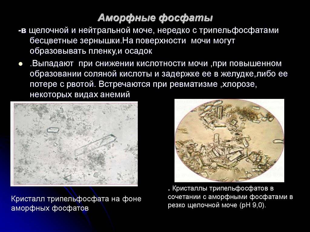 Ревматологическое обследование. анализ крови на уровень мочевой кислоты, ревматоидный фактор и пр.