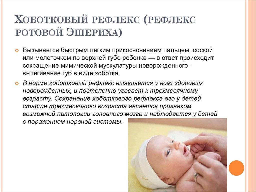 Оценка сосательного рефлекса и эффективности энтерального питания у новорожденных в течение первых месяцев жизни » акушерство и гинекология