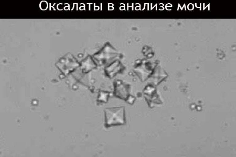 Анализ мочи на диабет: что нужно знать