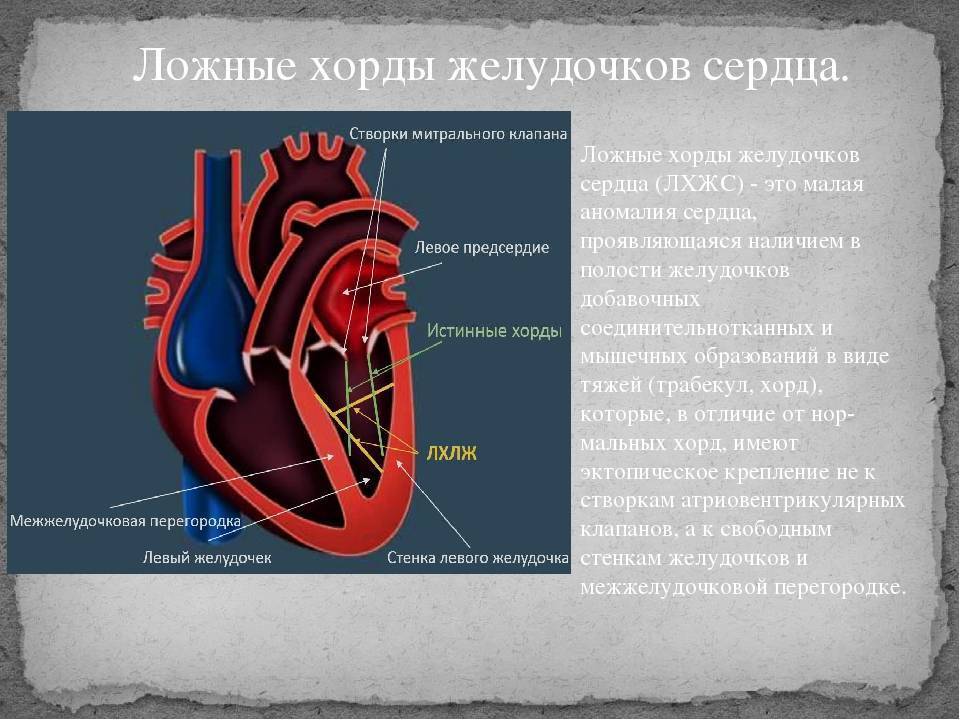 Диагноз марс у ребенка – что это такое в кардиологии? — сердце