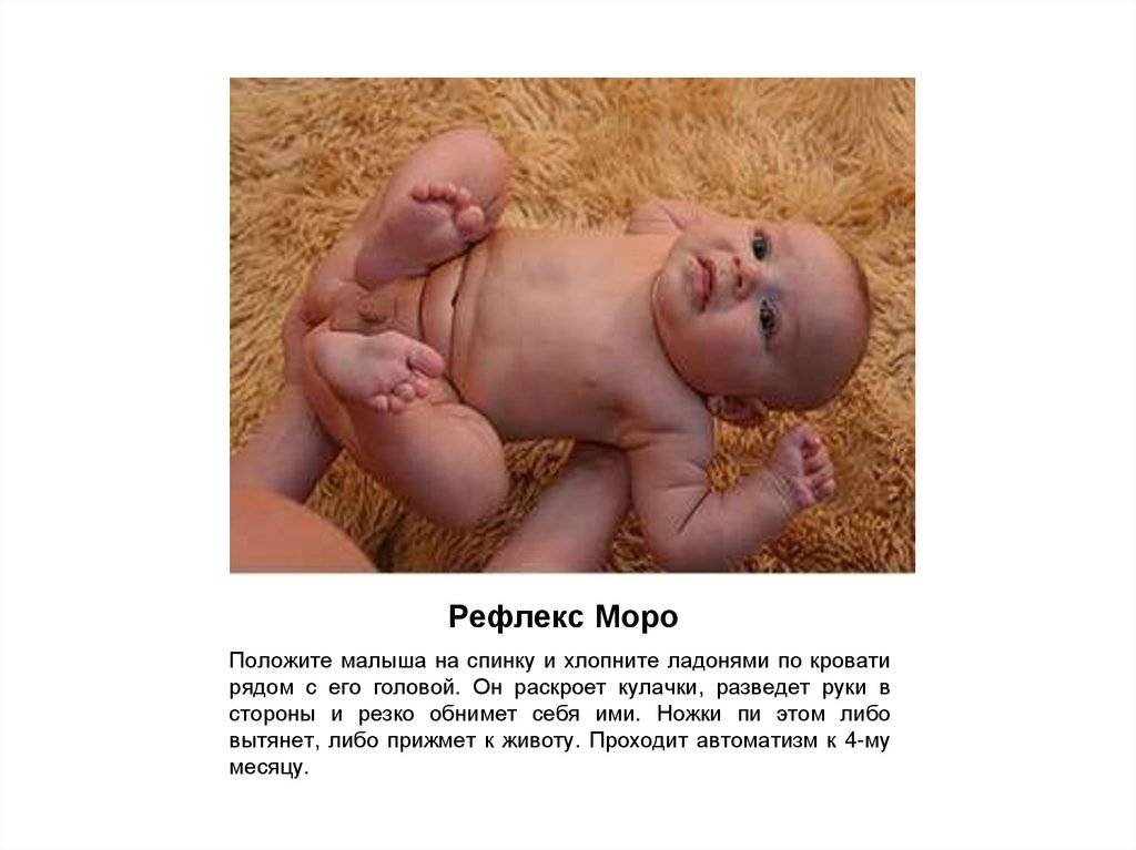 Основные особенности проявления рефлекса моро у новорожденных малышей