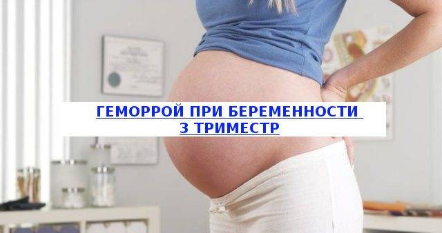 Геморрой и беременность