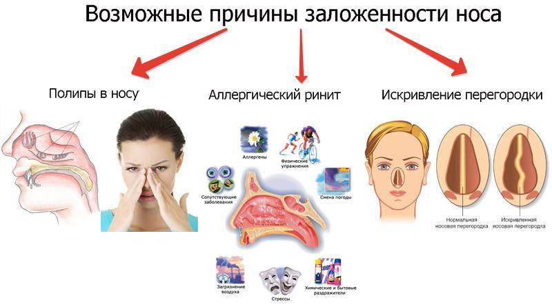 Доктор Комаровский о том, что делать, если нос заложен, но слизи нет
