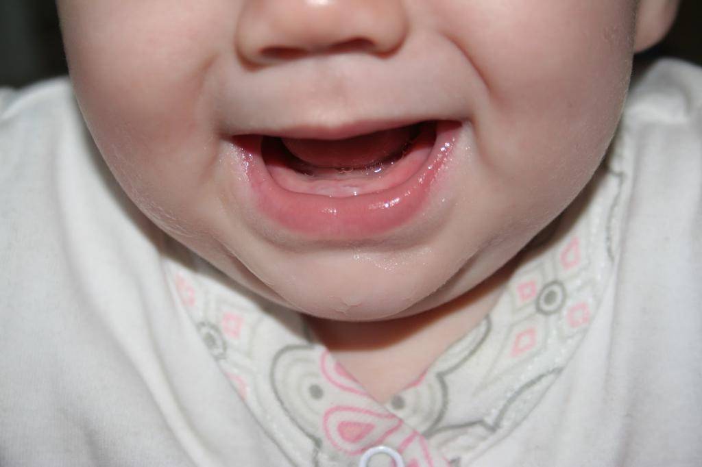 Глазные зубы у детей