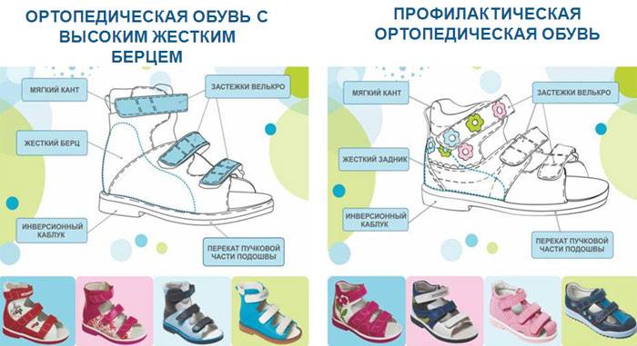Доктор комаровский о том, как выбрать обувь для малыша
