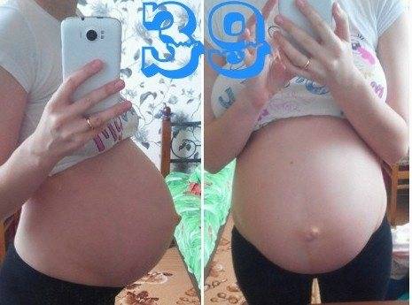Вторая беременность 39 недель. Опускание живота перед родами. Опущение живота перед родами. Опущение живота на 39 неделе.