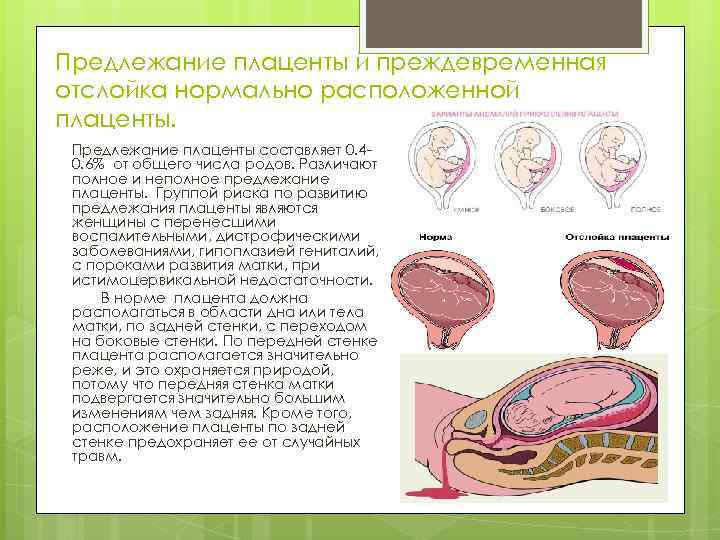 Предлежание плаценты (ппц) - признаки, причины, симптомы, лечение и профилактика - idoctor.kz