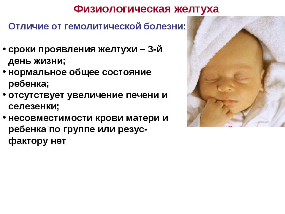 Желтуха новорожденных | симптомы | диагностика | лечение - docdoc.ru