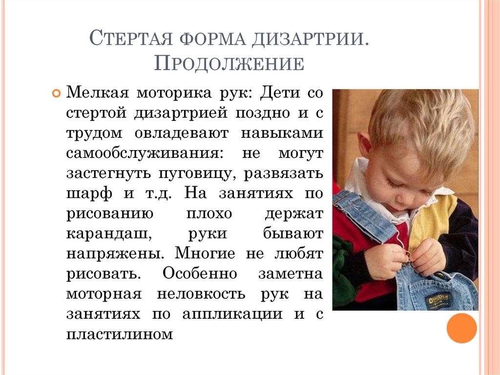 Дизартрия у детей: диагностика и коррекция - сибирский медицинский портал