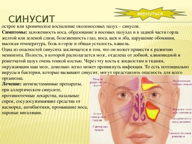 Синусит у ребенка
