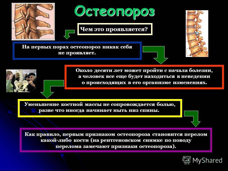 Остеопороз: симптомы и лечение. профилактика и диагностика остеопороза суставов.